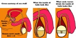 Rating: e
ID: 143408
Date: 2011-06-17 11:18:57 -0400
Status: active
Score: 54
2:1 ambiguous_species anatomy anthro balls biological_illustration clothed clothing cock_vore cross_section crotch_shot digital_media_(artwork) directional_arrow duo english_text flaccid genitals humor inside_balls internal male orange_body organs penile penis rant side_view simple_background solo_focus stick_figure technical_illustration text the_more_you_know topless unknown_artist urethra vore white_background post #143408